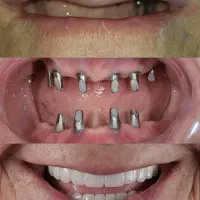 جشنواره ایمپلنت ،زیبایی،ارتودنسی، لمینیت|خدمات آرایشگری و زیبایی|صوفیان, |دیوار