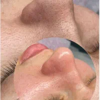 کلیه خدمات زیبایی و فیشال در کلینیک زیبایی میراکل|خدمات آرایشگری و زیبایی|لاهیجان, قیام|دیوار