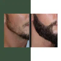 ریشی که آرزوشو داشتی