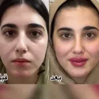 با ۳۵۰ تومن مدل انجام تمامی خدمات زیبایی شو|خدمات آرایشگری و زیبایی|شهریار, شهریار|دیوار