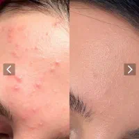 سرم مغذی ۱۵کاره/بیوممتیک فرانسوی اصل