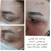 پوست زیبایی|خدمات آرایشگری و زیبایی|رباط‌کریم, الارد|دیوار