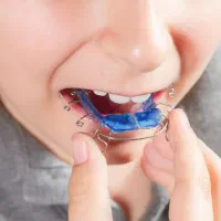 فرصت ویژه ارتودنسی رایگان برای کودکان ۹ تا ۱۱ سال|خدمات آرایشگری و زیبایی|تهران, پاسداران|دیوار