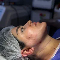 تخفیف عمل های زیبای لیپو/ ابدو/ ساکشن غبغب/بلفارو|خدمات زیبایی و سلامت|تهران, ونک|دیوار