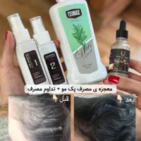 یک بار برای همیشه با ریزش مو هات خداحافظی کن|آرایشی، بهداشتی، درمانی|شیراز, چنچنه|دیوار
