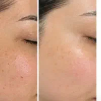 تخصصی ترین فیشال با ترکیب کربوکسی پلاژن