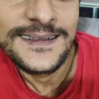 ساخت دندان مصنوعی کامل و تکه ای ضمانتی|آرایشی، بهداشتی، درمانی|مرودشت, بیست متری بیمارستان|دیوار