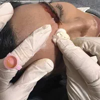 ریمووپاک کردن تتوتاتوابروصورت بدن|خدمات آرایشگری و زیبایی|رشت, فلسطین|دیوار