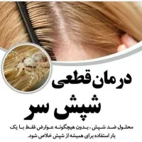 محلول ضد شپش