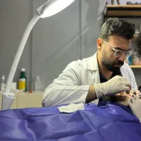 بلفارو پلاستی بدون جای بخیه تضمینی و فیلر و بوتاکس|خدمات آرایشگری و زیبایی|تبریز, |دیوار