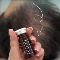 تزریق ژل و انواع مزو ژل های جوانساز|خدمات آرایشگری و زیبایی|بوشهر, |دیوار