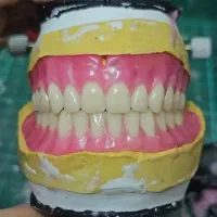 لابراتوار دندانسازی . دندان مصنوعی