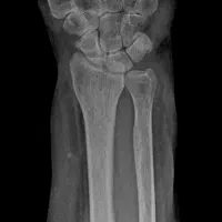 رادیولوژی و سونوگرافی در منزل تهران و کرج|پزشکی|تهران, ونک|دیوار