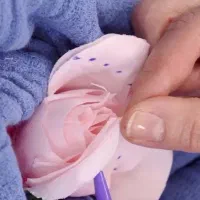 جراحی زیبایی زنان لابیاپلاستی تزریق چربی سفیدی بدن
