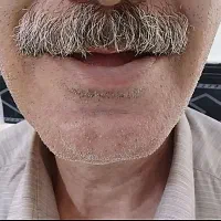 دندان کامل(شرایطی ویژه)|خدمات آرایشگری و زیبایی|سلطانیه, |دیوار