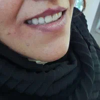 دندانسازی ، دندان مصنوعی|پزشکی|اصفهان, شاهد|دیوار