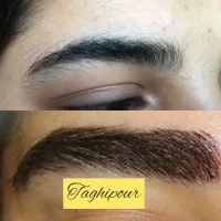کاشت مو و ابر به روش سوپر میکروگرفت|خدمات آرایشگری و زیبایی|اصفهان, دانشگاه اصفهان|دیوار