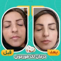 نمایندگی رویال دریاسوج ببرراضی نبودی پس میگیریم|آرایشی، بهداشتی، درمانی|دوگنبدان, |دیوار