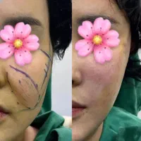 لیفت شقیقه و صورت|خدمات آرایشگری و زیبایی|اهواز, کیان اباد|دیوار