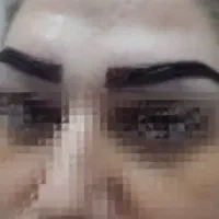 کاشت مو و ابرو و ریش پرتراکم|خدمات زیبایی و سلامت|شیراز, ستارخان|دیوار