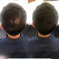 سرم سیر سیاه(قطع ریزش مو تضمینی)|آرایشی، بهداشتی، درمانی|تبریز, |دیوار