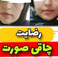 چاقی صورت / پودر جوانه گندم بین استار اصلی|خوردنی و آشامیدنی|مشهد, مشکینی (شهرک غرب)|دیوار