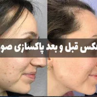 آموزش کوپ آموزش مژه آموزش کاشت ناخن فیبروز نصف راه|خدمات آموزشی|تبریز, |دیوار