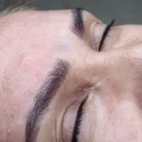 میکروبلیدینگ