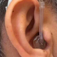 تجویز سمعک هوشمند نامرئی و پشت گوشی و شارژی|آرایشی، بهداشتی، درمانی|تهران, شهرک دانشگاه|دیوار