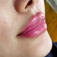 تخفیف تکرارنشدنی