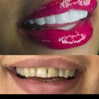 دندانپزشکی عصب کشی ،روکش،ایمپلنت،کامپوزیت|خدمات آرایشگری و زیبایی|بروجرد, |دیوار