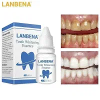 سرم سفید کننده دندان(پرداخت درب منزل)