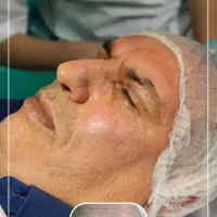 بلفارو پلاستی ( جراحی افتادگی پلک)آقایان و بانوان|خدمات آرایشگری و زیبایی|تهران, تهرانسر مرکزی|دیوار