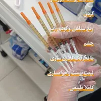 ریموو تاتو/ریزش سکه ای/مزوتراپی/خال برداری/فیشیال|خدمات آرایشگری و زیبایی|شیراز, دلگشا|دیوار