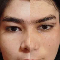 دستیارجراح (تکنسین اتاق عمل)هستم