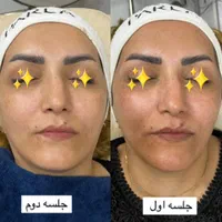 جشنواره فشیال تخصصی با ۵۰٪ تخفیف فقط برای ۵ نفر|خدمات آرایشگری و زیبایی|یزد, |دیوار