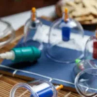 پزشکی.حجامت.