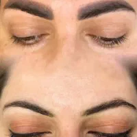 ریموو پاک کردن تک جلسه ای تتو