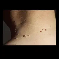 خال|خدمات آرایشگری و زیبایی|سرپل ذهاب, |دیوار