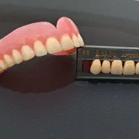 ساخت پروتز متحرک (( دندانسازی ))