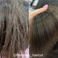 موخوره گیری تخصصی