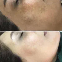 برای زیبایی تلاش کن