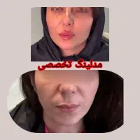 جراحی لابیا پلاستی .چربی صورت وبدن|خدمات آرایشگری و زیبایی|رباط‌کریم, رباط‌کریم|دیوار