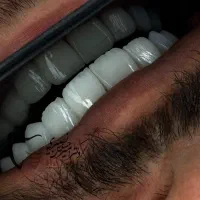 دندانپزشکی تخصصی ، ایمپلنت ، اوردنچر ، زیبایی