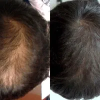 اسکالپ سر و فیبروز ابرو|خدمات آرایشگری و زیبایی|شیراز, ملاصدرا|دیوار