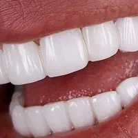 لمینت و کامپوزیت