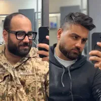 کاشت مو ابرو ریش اقساطی. مزو تراپی و پی ار پی