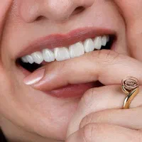 دندانپزشکی/لمینیت/کامپوزیت/جراحی دندان/ایمپلنت|خدمات آرایشگری و زیبایی|تهران, میدان ولیعصر|دیوار