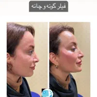 کلینیک پوست و مو و لیزر و زیبایی در اسلامشهر|خدمات آرایشگری و زیبایی|اسلام‌شهر, باغ فیض|دیوار
