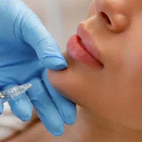 خدمات زیبایی و جوانسازی|خدمات آرایشگری و زیبایی|یاسوج, |دیوار